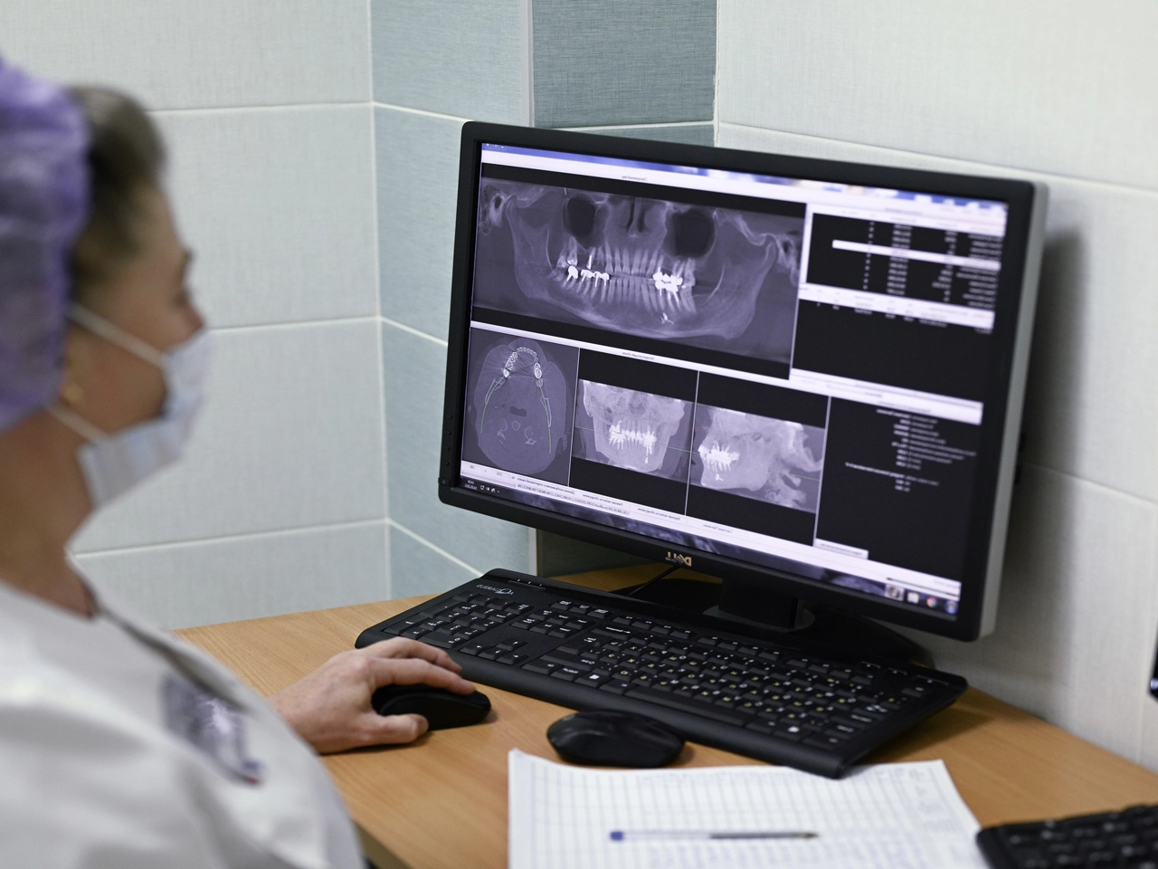 Визиография зуба