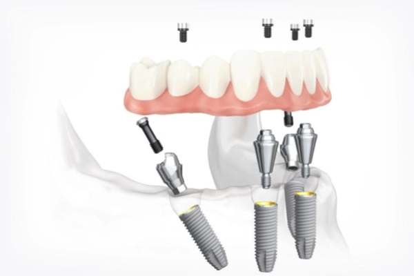 болит зуб.jpg