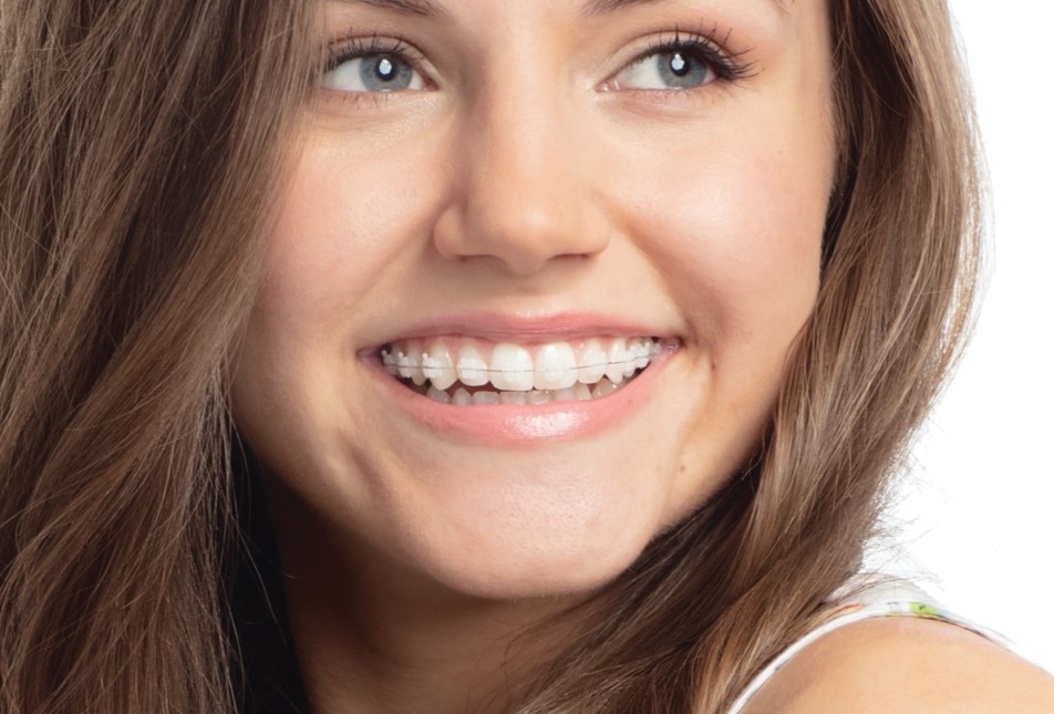 Brooke Symetri Clear.jpg